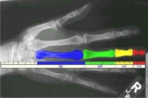 fib_hand fib_hand